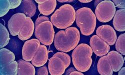 “Super Gonorrhea” is increasing around the World